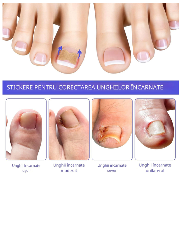 Patch-uri Corectoare Unghii
